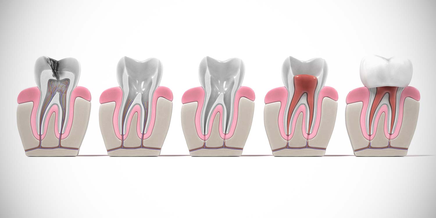 Endodontia